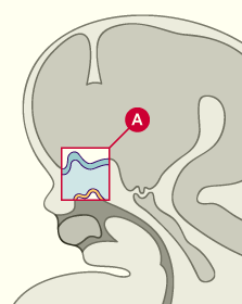 media/module22/v10m_olfact_plan.gif