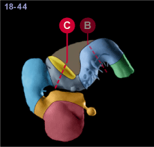 media/module22/v7a_planC_st18.gif