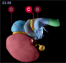 media/module22/v7a_planC_st23.gif