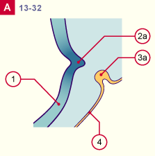 media/module22/v7f_adenohypo_st13.gif