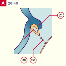 media/module22/v7f_adenohypo_st20.gif