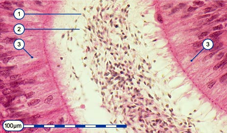 media/module3/3_1_spermnebhoden.jpg