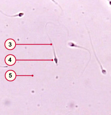 media/module4/d0b_Ejaknativ.jpg