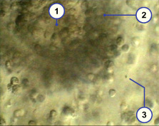 media/module4/d4_sperminradiata.jpg