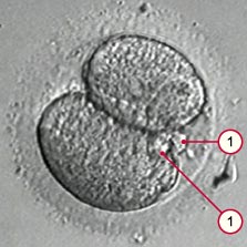 media/module5/e1j_semmel.jpg