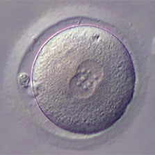 media/module5/e1p_j1_zygote.jpg