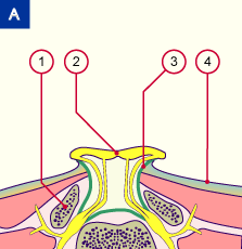 media/module7/h6d_myeloschisis_b.gif