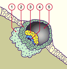 media/module8/carnegie/f2i_implant7j2_synop.gif