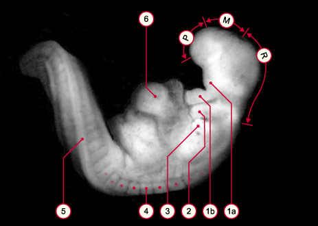 media/module8/carnegie/i1_kyotostad12.jpg