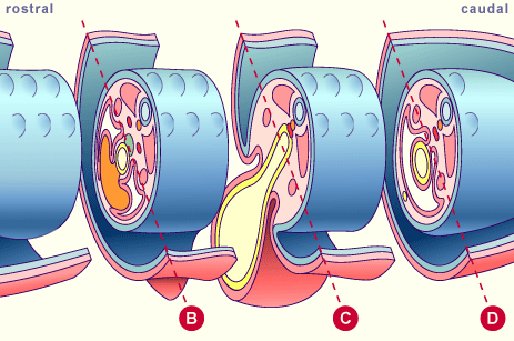 media/module8/i4i_plicature.gif