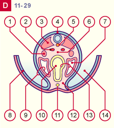 media/module8/i4l_coupD_st11.gif