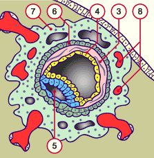 media/multuse/f2m_implant10j2.gif