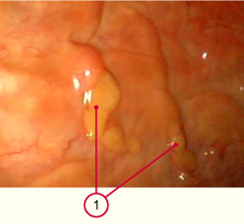 media/vet/module6/endometrial_cups.jpg